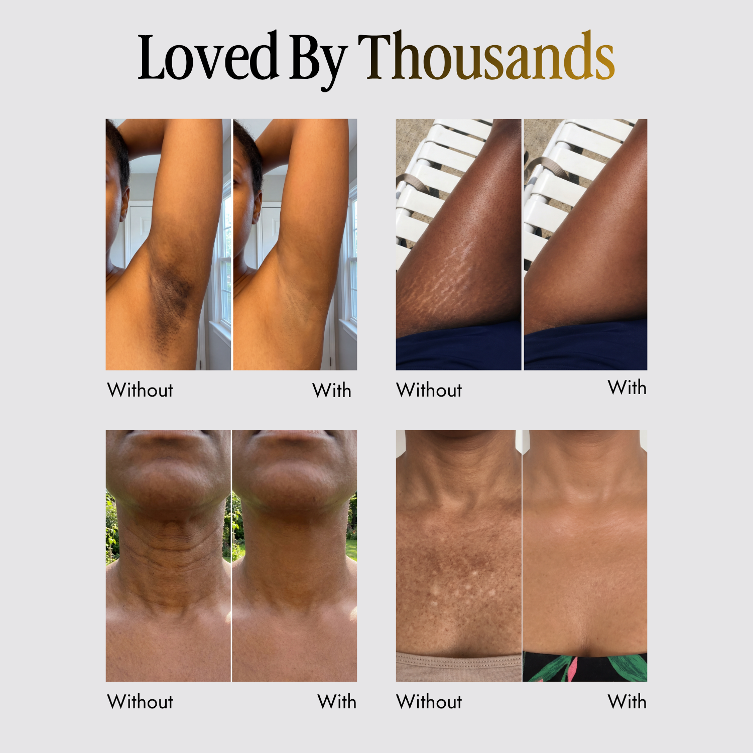 Shems™ Black Seed Oil Body Coverage Perfector